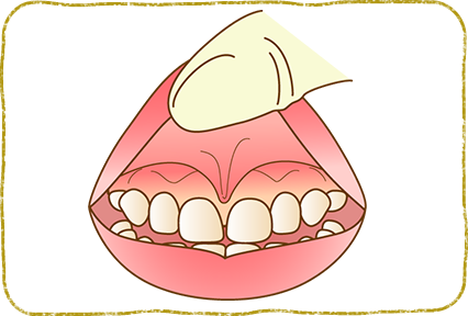 レーザーで切開し、縫合します。レーザーによる治療ですので、痛みはほぼありません。