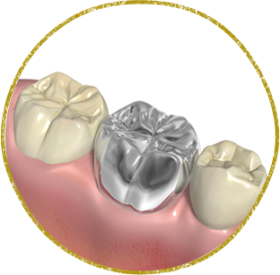 西東京市西原町・おばら歯科医院・詰め物・被せ物