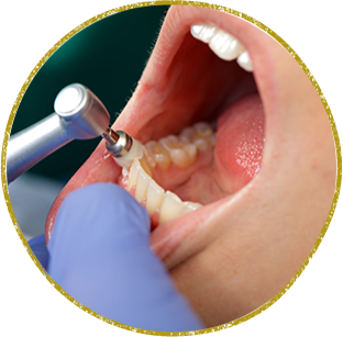 西東京市西原町・おばら歯科医院・予防・クリーニング